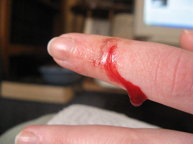 bleeding!